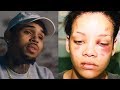 Chris Brown Details Rihanna Assault: She Tried To Kick Me, I Bit Her Arm