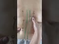 Teknik Cara Memijat Punggung Yang Benar Punggung Pijatpunggung Punggungsakit