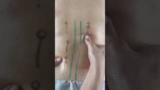 Download lagu Teknik cara memijat punggung yang benar   #punggung #pijatpunggung #punggungsakit mp3