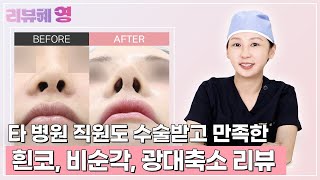 타 성형외과 직원이 와서 #광대 #코성형 받고 간 썰 l 와이영성형외과 /ほほ骨縮小/鼻整形/鼻手術/鼻先整形/鼻筋整形/団子鼻矯正/韓国整形/韓国美容外科/女医