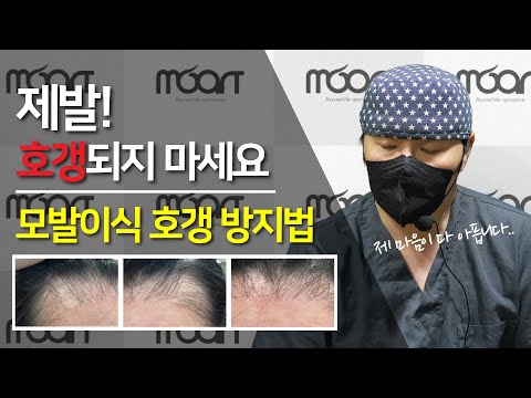 모발이식 호갱이 되지 않으려면!? | 모발이식 호갱 방지법 | 후회하면 돌이킬수 없습니다