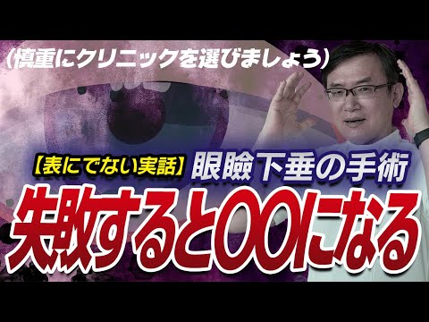 医学科 【実話】眼瞼下垂の手術、失敗するとどうなるのか