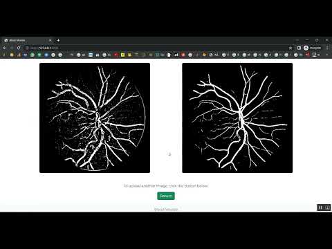 Retinal Vessel Image Analysis Jupyter Flask App in Python Projects