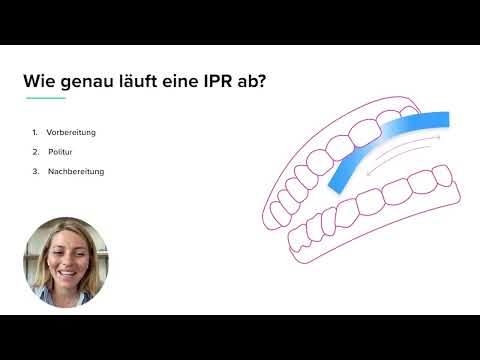 DR SMILE Explains: Was ist eine IPR?