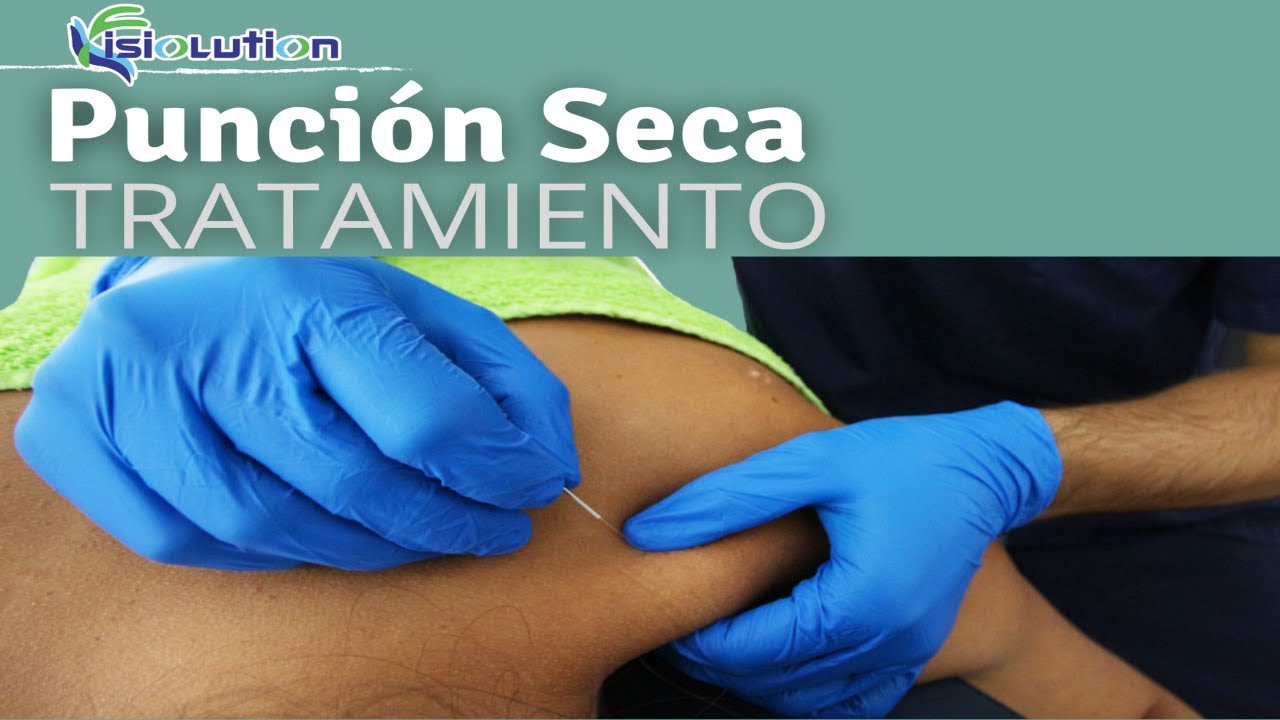 Watch ¿Qué es la PUNCIÓN SECA TRATAMIENTO para PUNTOS GATILLO | Fisiolution Now ¿Qué es la PUNCIÓN SECA TRATAMIENTO para PUNTOS GATILLO | Fisiolution