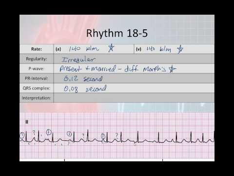 Basic Electrophysiology, part 7 - Atrial Rhyhtms, part 2, WAP MAT EAT SVT