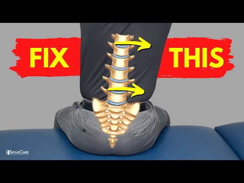 5 Exercises to Fix an Achy Tilted Back