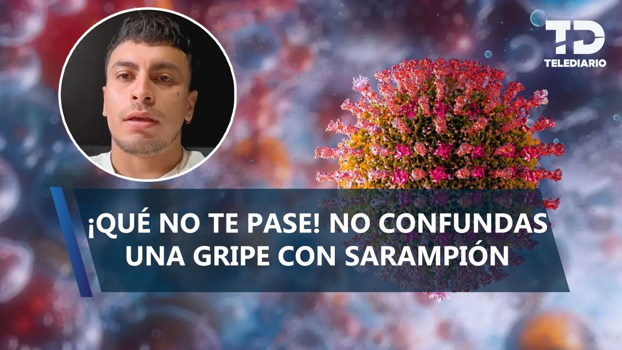 Bruno pensó tener gripe, pero terminó siendo sarampión: ¿Cómo diferenciar los síntomas?