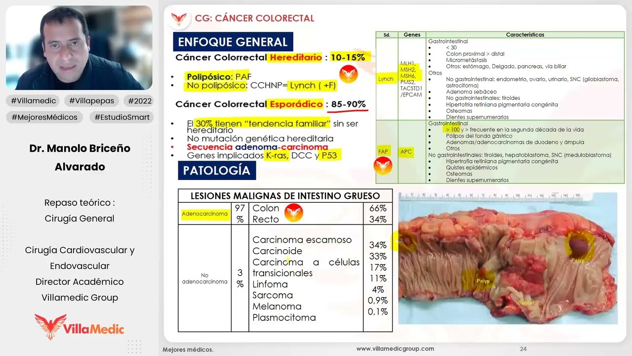 CÁNCER COLORRECTAL PARTE 1 - CIRUGÍA GENERAL - VILLAMEDIC