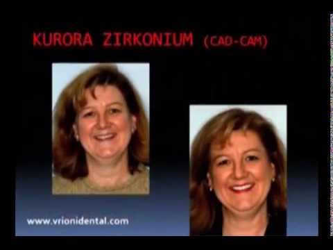 Klinika Dentare VRIONI- Spot  Stomatologjia Estetike