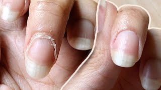 NAIL TRANSFORMATION | how I CUT CUTICLES at  HOME | Basic Tools ONLY