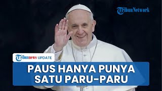 Fakta Unik Paus Fransiskus: Hanya Punya 1 Paru-paru, Ahli Kimia hingga Penggemar Berat Sepak Bola