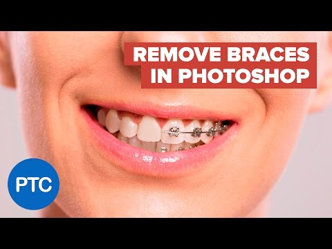 Remove Braces in Photoshop Easy Pro Level Results