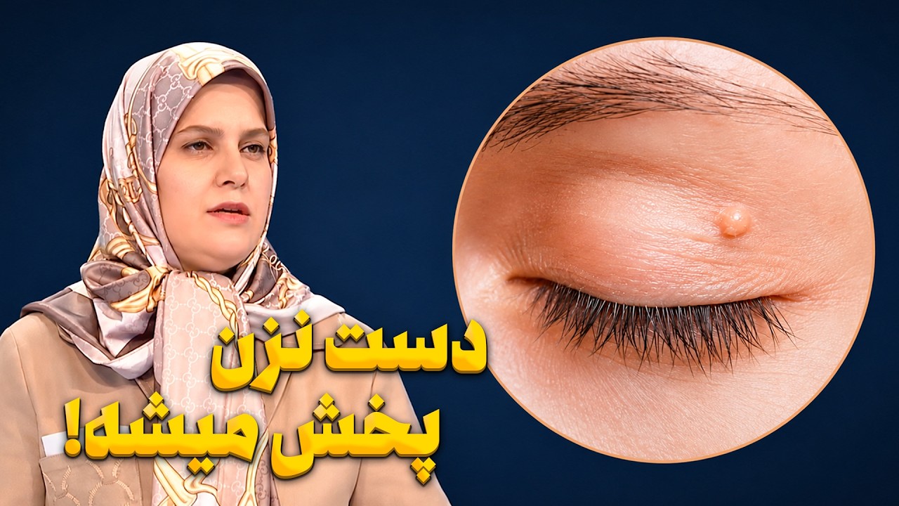 علائم خطرناک ضایعات و توده‌های دور چشم که نباید نادیده گرفت! 👁️⚠️