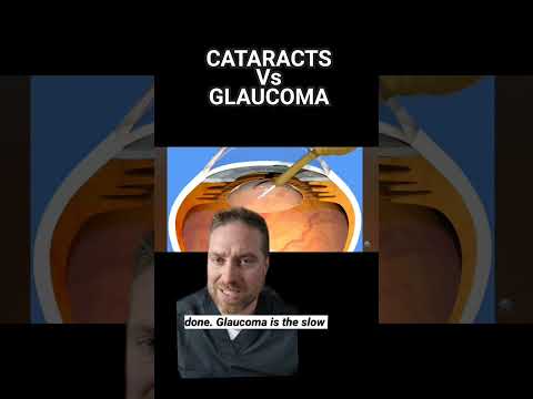 Cataracts Vs Glaucoma (What Is The Difference?)