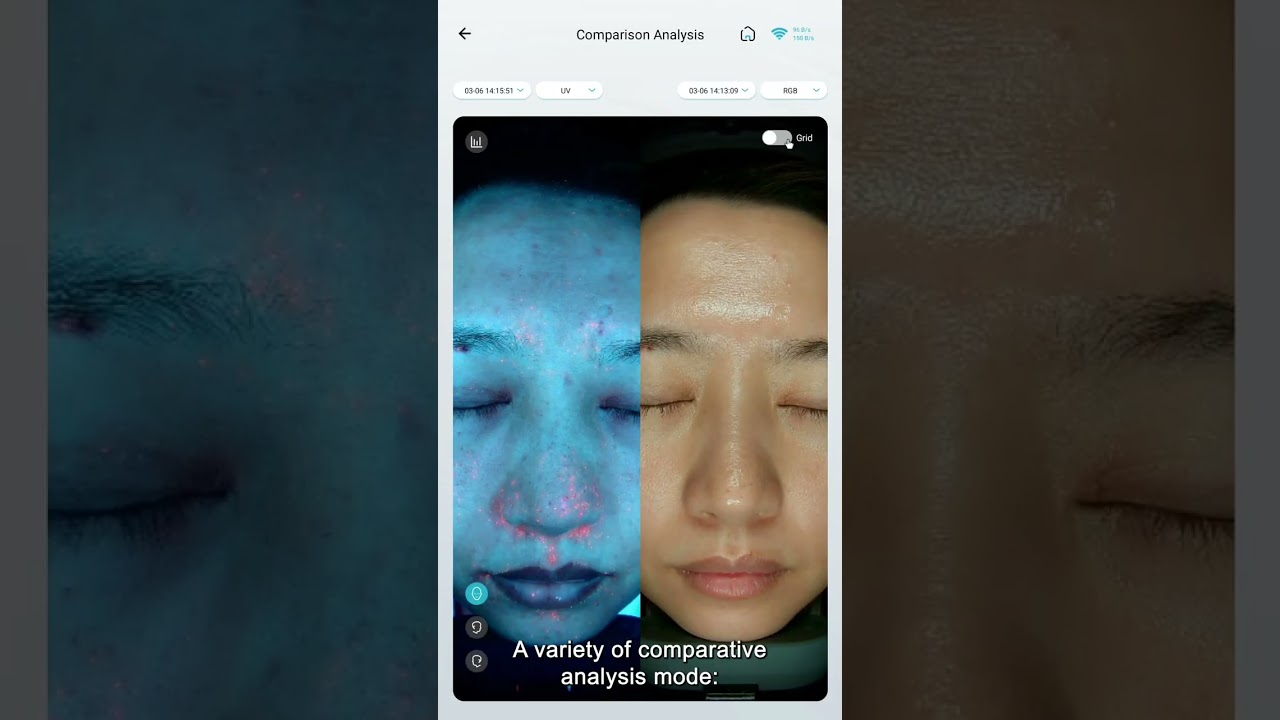 AI Skin Analyzer Review 2025 | The Future of Smart Skin Diagnosis