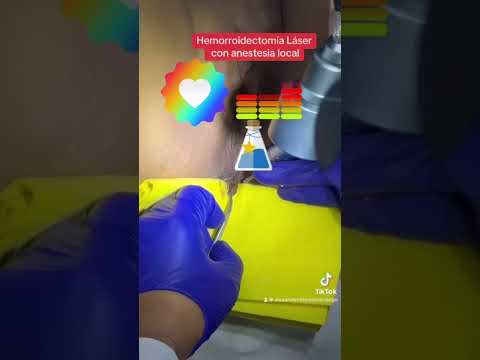 Alexander Alonso Lázaro Chumbe-32