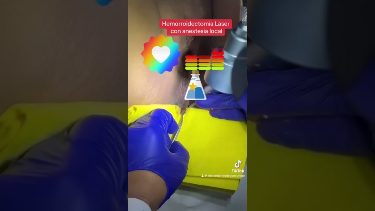 Alexander Alonso Lázaro Chumbe-32