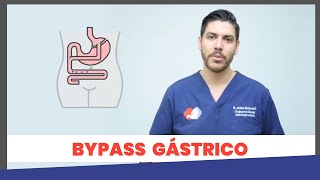 Bypass Gástrico en Monterrey - Jerónimo Monterrubio