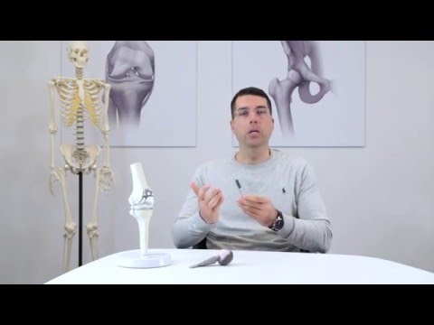 Was für Arthritis des Gelenkes zu essen Goldener Schnurrbart von Gebärmutterhalskrebs degenerativer Bandscheibenerkrankungen