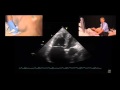Pulmonary Hypertension Echocardiography Findings