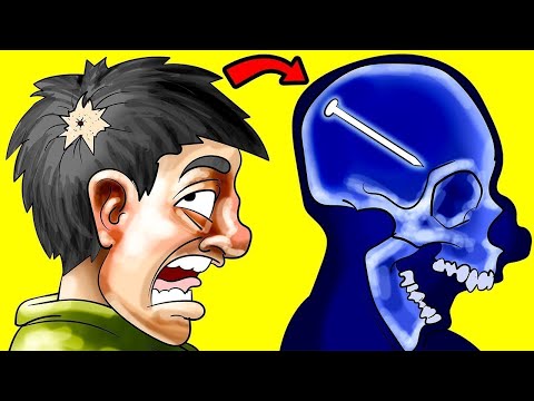 How These People Survived The Impossible – Part 10