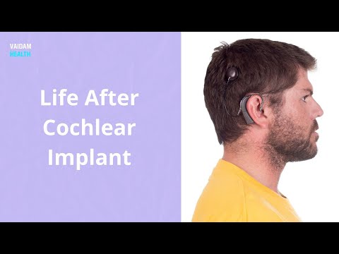 Life After Cochlear Implant