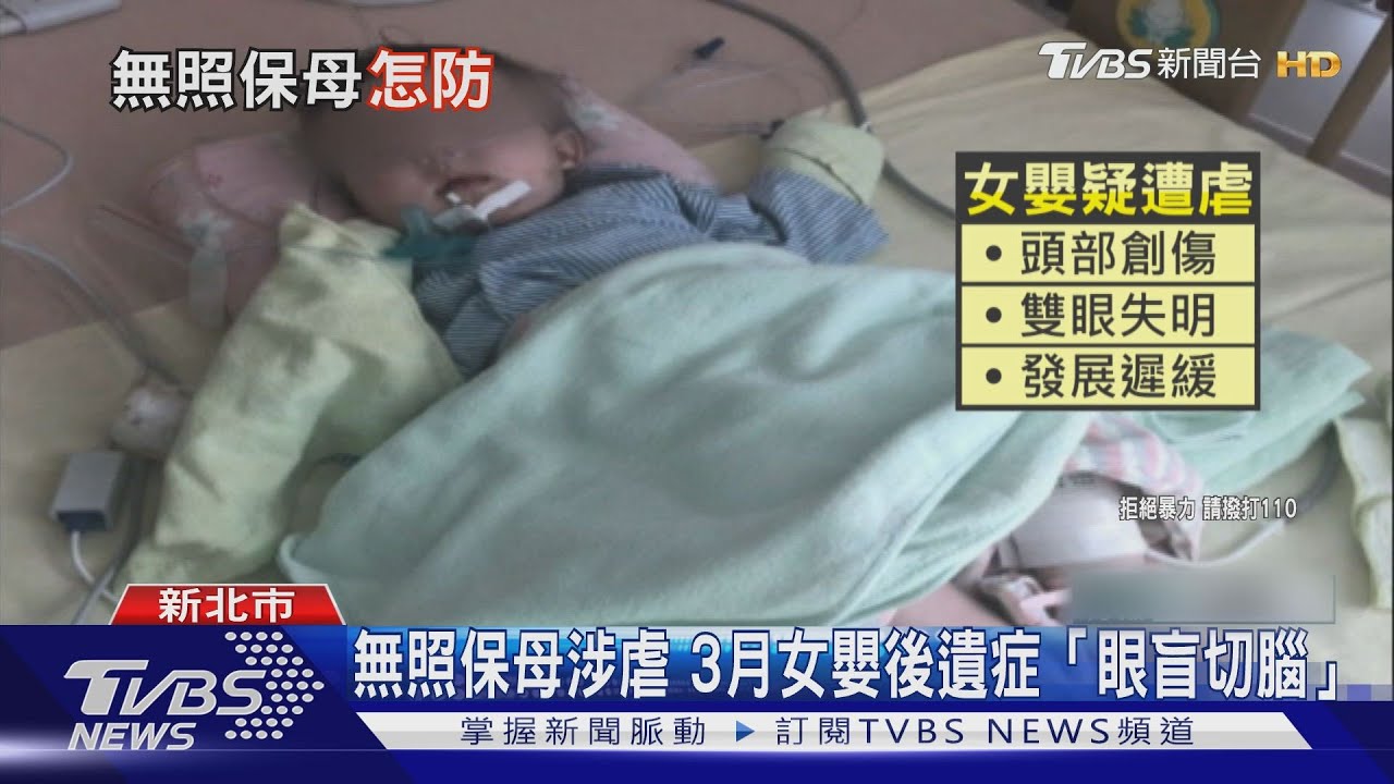 託友照顧變重殘 3月女嬰「眼盲切腦」保母無照罰6千
