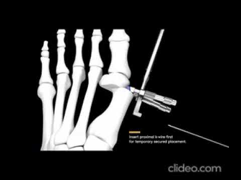 Need Help with NDIS Registration? Learn How Marketing Can Simplify the Process