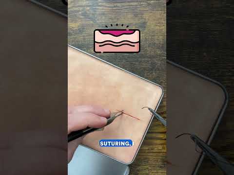 Common Suturing Mistakes!
