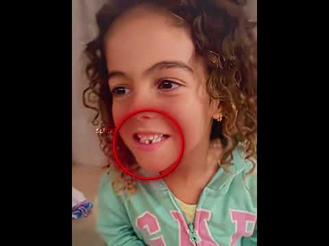 Ronaldo's Tooth Prank to Alana 😂