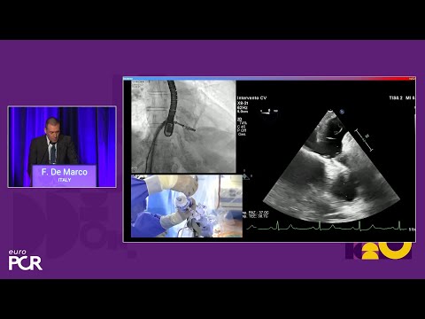 Enhancing clipping solutions for durable long-term patient outcomes - EuroPCR 2025
