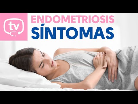 Síntomas de la endometriosis