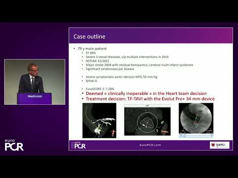 Your most challenging TAVI cases - Achieving precision & control with Evolut platform - EuroPCR 2022