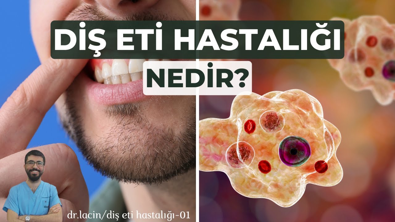 Çağdaş Çağlar Laçin-2