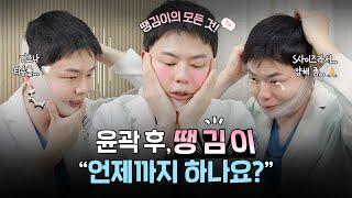 윤곽 후 땡김이 착용에 대한 모든 것(착용꿀팁+현웃주의)