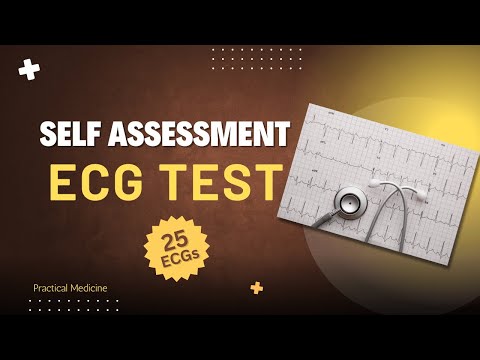 Self Assessment ECG Test #OSCES #ecginterpretation #ecg #ekg