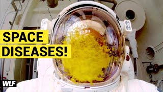 5 Most MYSTERIOUS Space Diseases!