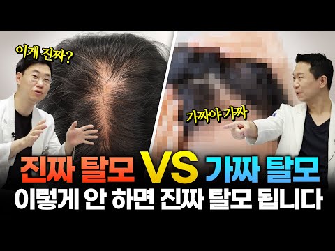 머리카락 하루에 00개 빠지면 탈모 아니다? 진짜 가짜 탈모 구별법 [ENG CN JP SUB]