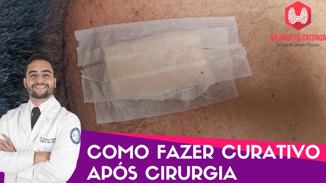 Como fazer curativo após uma cirurgia!
