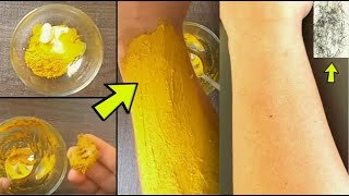 Remove Unwanted Hair Permanently at Home  |  DIY Unwanted Hair Removal for Women Naturally