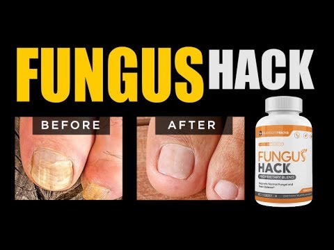 download lagu mp3 mp4 Fungus Hack, download lagu Fungus Hack gratis, unduh video klip Fungus Hack
