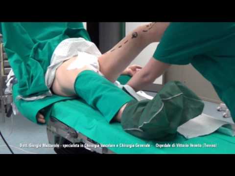 Lo spostamento della colonna cervicale nei neonati Artrosi del ginocchio trattamento rimedi popolari 1 grado