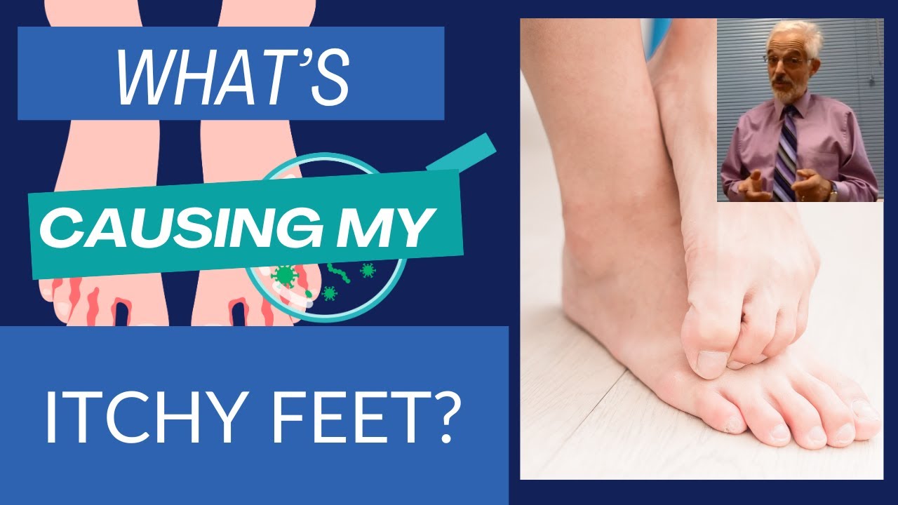What's Causing My Itchy Feet and How to Treat It? Foot and Ankle
