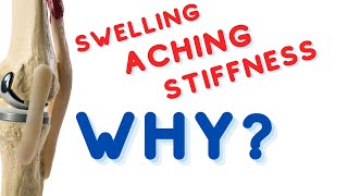 Stiffness, Swelling, Aching: After Total Knee Replacement