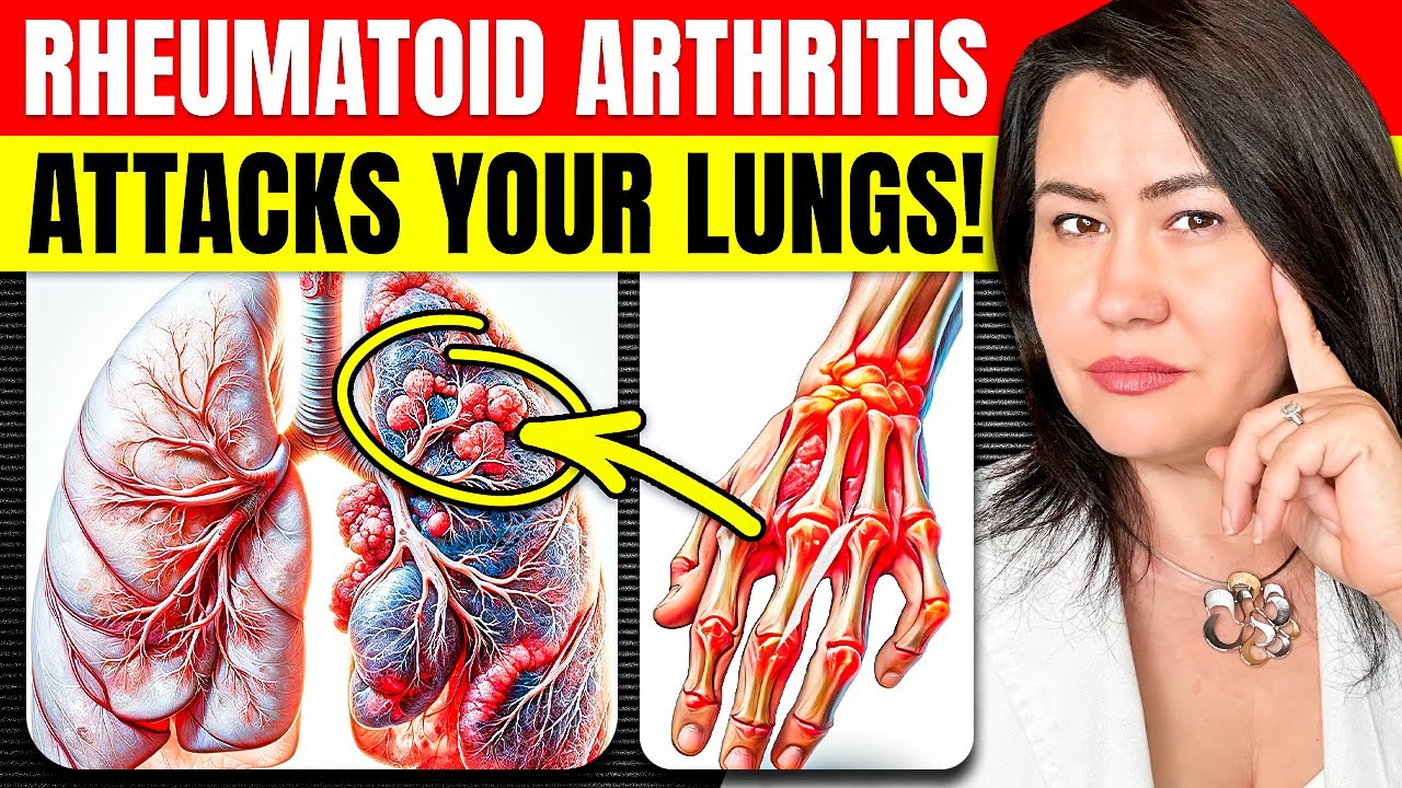 The Scary Link Between Rheumatoid Arthritis and Lung Damage!