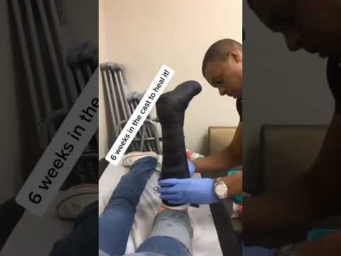 My Trick for a Short Leg Cast #shorts #injury #sportsmedicine