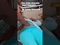 Navel Displacement Gas Acidity Acidity