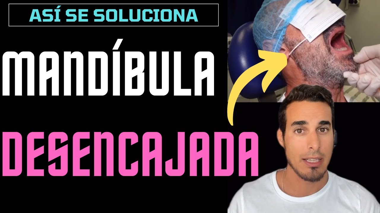 Watch MANDÍBULA DESENCAJADA - Así se soluciona - LUXACIÓN y maniobra de Nelaton Now MANDÍBULA DESENCAJADA - Así se soluciona - LUXACIÓN y maniobra de Nelaton