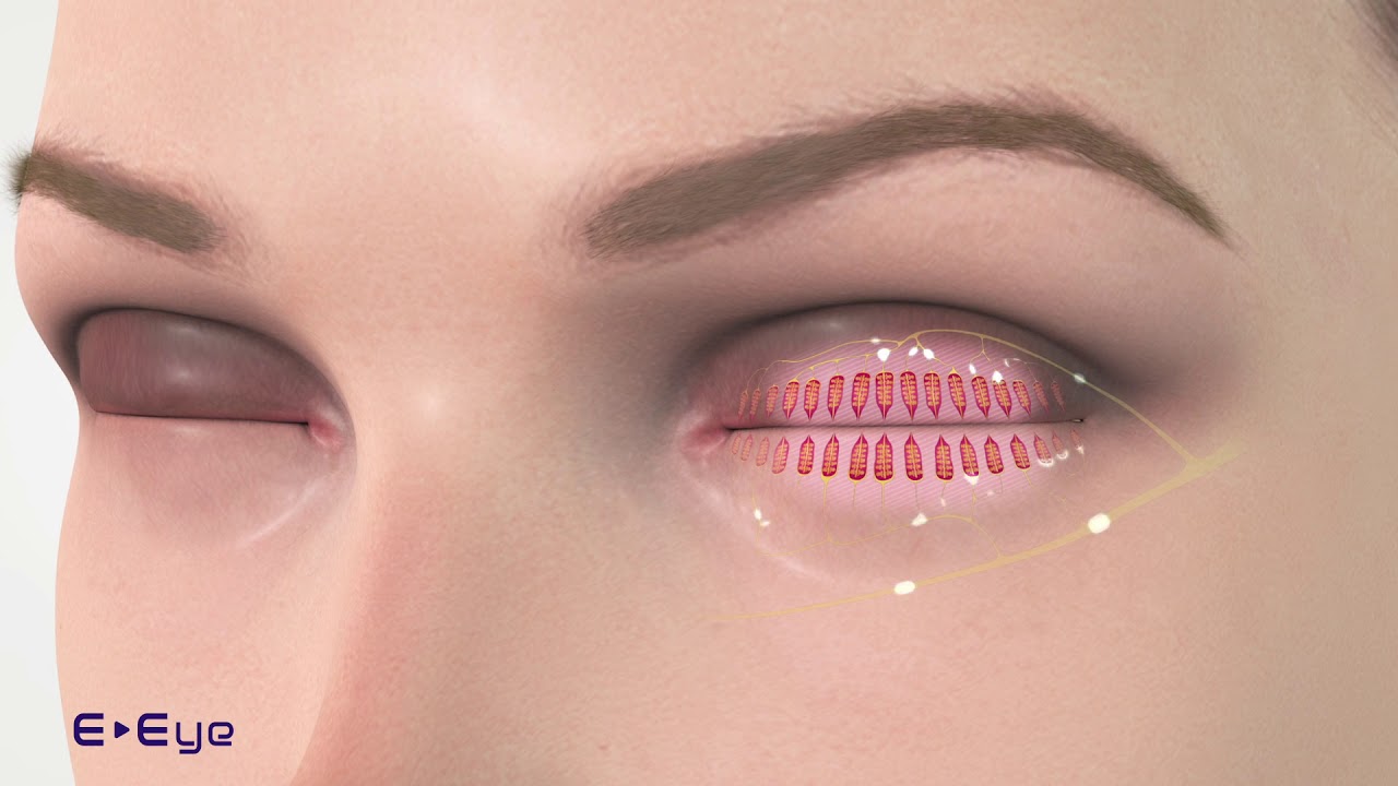 Jarbas Emílio De Moraes Neto-24